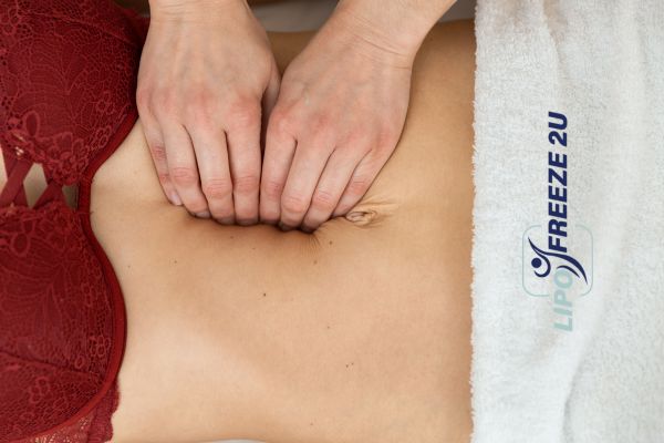 diastasis recti treatment Redditch