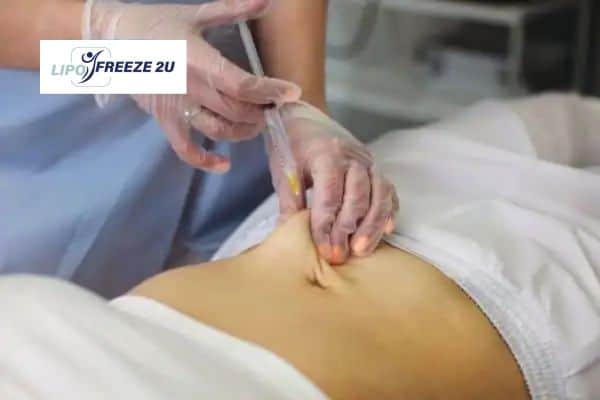 How Does Aqualyx Fat Dissolving Injection Work to Break Down Fat Redditch?