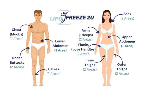 Areas you can have fat freezing treatment Redditch