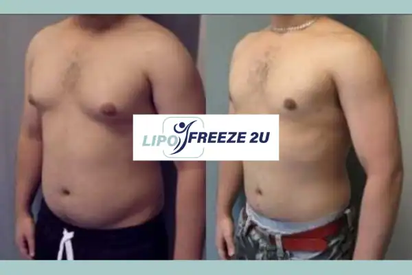 How Long Does It Take to See Results Redditch?