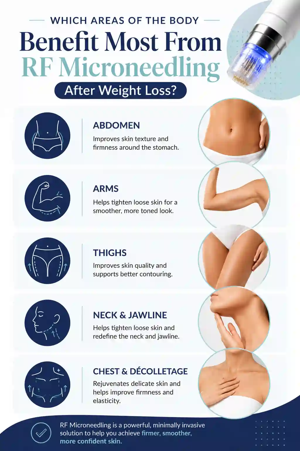 Which Areas of the Body Benefit Most From RF Microneedling After Weight Loss Redditch